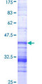 NEK1 Protein - 12.5% SDS-PAGE Stained with Coomassie Blue.