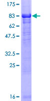 NEK10 Protein - 12.5% SDS-PAGE of human NEK10 stained with Coomassie Blue