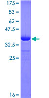 NEK10 Protein - 12.5% SDS-PAGE Stained with Coomassie Blue.