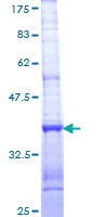 NEK11 Protein - 12.5% SDS-PAGE Stained with Coomassie Blue.