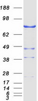 NEK11 Protein - Purified recombinant protein NEK11 was analyzed by SDS-PAGE gel and Coomassie Blue Staining