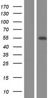 NEK2 Protein - Western validation with an anti-DDK antibody * L: Control HEK293 lysate R: Over-expression lysate
