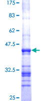 NEK2 Protein - 12.5% SDS-PAGE Stained with Coomassie Blue.