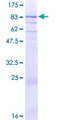 NEK3 Protein - 12.5% SDS-PAGE of human NEK3 stained with Coomassie Blue