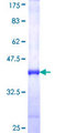 NEK4 Protein - 12.5% SDS-PAGE Stained with Coomassie Blue.