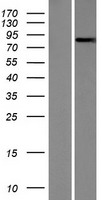 NEK5 Protein - Western validation with an anti-DDK antibody * L: Control HEK293 lysate R: Over-expression lysate