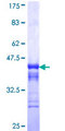 NEK5 Protein - 12.5% SDS-PAGE Stained with Coomassie Blue.