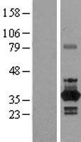 NEK6 Protein - Western validation with an anti-DDK antibody * L: Control HEK293 lysate R: Over-expression lysate