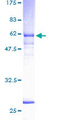 NEK6 Protein - 12.5% SDS-PAGE of human NEK6 stained with Coomassie Blue