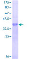 NEK6 Protein - 12.5% SDS-PAGE Stained with Coomassie Blue.