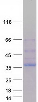 NEK6 Protein - Purified recombinant protein NEK6 was analyzed by SDS-PAGE gel and Coomassie Blue Staining