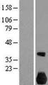 NEK7 Protein - Western validation with an anti-DDK antibody * L: Control HEK293 lysate R: Over-expression lysate