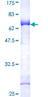NEK7 Protein - 12.5% SDS-PAGE of human NEK7 stained with Coomassie Blue