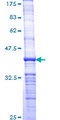 NEK7 Protein - 12.5% SDS-PAGE Stained with Coomassie Blue.