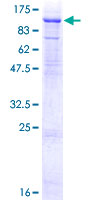 NEK8 Protein - 12.5% SDS-PAGE of human NEK8 stained with Coomassie Blue