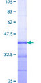 NEK8 Protein - 12.5% SDS-PAGE Stained with Coomassie Blue.