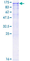 NEK9 Protein - 12.5% SDS-PAGE of human NEK9 stained with Coomassie Blue
