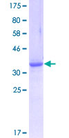 NEK9 Protein - 12.5% SDS-PAGE Stained with Coomassie Blue.