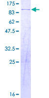 NELFA / WHSC2 Protein - 12.5% SDS-PAGE of human WHSC2 stained with Coomassie Blue