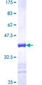 NELFA / WHSC2 Protein