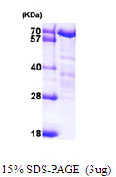 NELFA / WHSC2 Protein