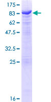NELFCD / TH1L / TH1 Protein - 12.5% SDS-PAGE of human TH1L stained with Coomassie Blue