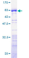 NELFE / RD / RDBP Protein - 12.5% SDS-PAGE of human RDBP stained with Coomassie Blue