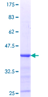 NELFE / RD / RDBP Protein - 12.5% SDS-PAGE Stained with Coomassie Blue.