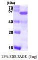 NELFE / RD / RDBP Protein
