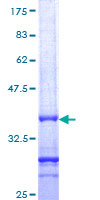NELL1 Protein - 12.5% SDS-PAGE Stained with Coomassie Blue.