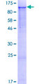 NELL2 Protein - 12.5% SDS-PAGE of human NELL2 stained with Coomassie Blue
