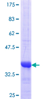 NELL2 Protein - 12.5% SDS-PAGE Stained with Coomassie Blue.