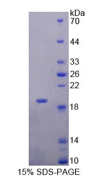 NENF / Neudesin Protein - Recombinant Neudesin Neurotrophic Factor By SDS-PAGE