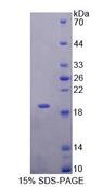 NENF / Neudesin Protein - Recombinant Neudesin Neurotrophic Factor By SDS-PAGE