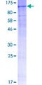 NEP / DDR1 Protein - 12.5% SDS-PAGE of human DDR1 stained with Coomassie Blue