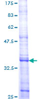 NEP / DDR1 Protein - 12.5% SDS-PAGE Stained with Coomassie Blue.