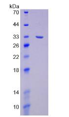 NEP / DDR1 Protein - Recombinant Discoidin Domain Receptor Family, Member 1 By SDS-PAGE