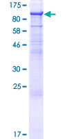 NEPH2 / KIRREL3 Protein - 12.5% SDS-PAGE of human KIRREL3 stained with Coomassie Blue