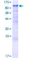 NEPH2 / KIRREL3 Protein - 12.5% SDS-PAGE of human KIRREL3 stained with Coomassie Blue