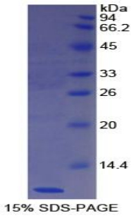 Nesfatin-1 Protein - Recombinant Nesfatin 1 By SDS-PAGE