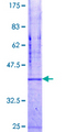 NET1 / ARHGEF8 Protein - 12.5% SDS-PAGE Stained with Coomassie Blue.