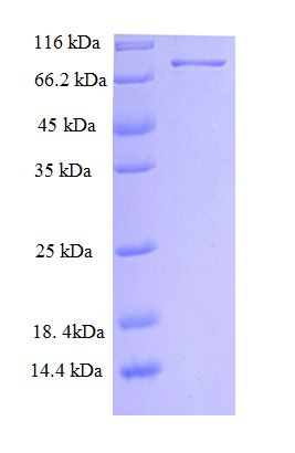 NET1 / ARHGEF8 Protein