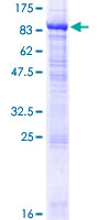 NETO1 Protein - 12.5% SDS-PAGE of human NETO1 stained with Coomassie Blue