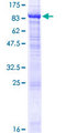 NETO1 Protein - 12.5% SDS-PAGE of human NETO1 stained with Coomassie Blue