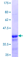 NETO1 Protein - 12.5% SDS-PAGE Stained with Coomassie Blue.
