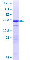 NETO2 Protein - 12.5% SDS-PAGE of human NETO2 stained with Coomassie Blue