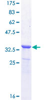 NETO2 Protein - 12.5% SDS-PAGE Stained with Coomassie Blue.