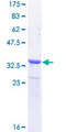 NETO2 Protein - 12.5% SDS-PAGE Stained with Coomassie Blue.