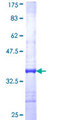 NEU1 / NEU Protein - 12.5% SDS-PAGE Stained with Coomassie Blue.