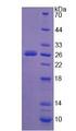 NEU1 / NEU Protein - Active Neuraminidase (NEU) by SDS-PAGE